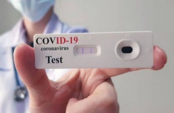 Self test: Διαθέσιμα από την Τετάρτη σε 11.000 φαρμακεία
