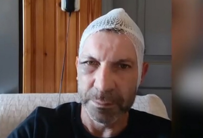 Ξυλοδαρμός Παναιτώλιο: “Η οικογένεια μου και εγώ δεχόμαστε απειλές”