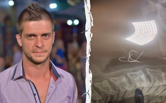 Αγρίνιο – Νίκος Σταμούλης: Κινδύνευσα να πεθάνω από τα αγκίστρια στο χταπόδι – Τη νύχτα στο «Γεννηματάς» η επέμβαση