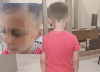 Έδειραν 5χρονο σε… νηπιαγωγείο του Αγρινίου συμμαθητές του!