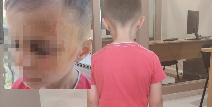 Έδειραν 5χρονο σε… νηπιαγωγείο του Αγρινίου συμμαθητές του!