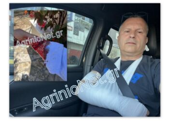 Αιτωλικό: κινδύνευσε από δάγκωμα σκύλου ο δικηγόρος Σωτήρης Μπούρος στο Αιτωλικό. Πολύ σοβαρός ο τραυματισμός του στο χέρι. Τι λέει για το περιστατικό. Τι απαντά ο Χρ. Τέγας