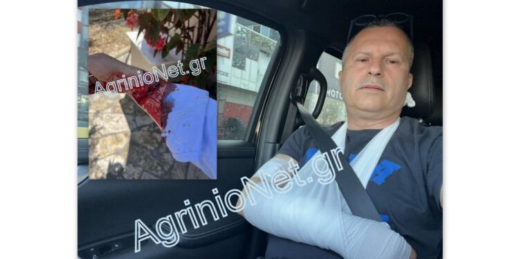 Αιτωλικό: κινδύνευσε από δάγκωμα σκύλου ο δικηγόρος Σωτήρης Μπούρος στο Αιτωλικό. Πολύ σοβαρός ο τραυματισμός του στο χέρι. Τι λέει για το περιστατικό. Τι απαντά ο Χρ. Τέγας