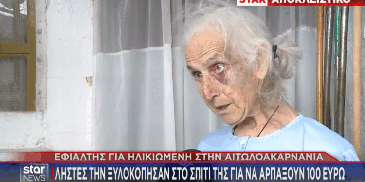Ληστεία στο Αγγελόκαστρο Αγρινίου: Σοκάρει η εικόνα του θύματος – «Τους παρακαλούσα, μη με χτυπάτε άλλο», λέει η 85χρονη