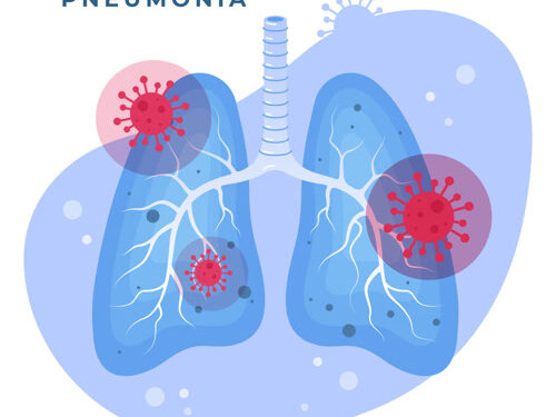 12 Νοεμβρίου – Παγκόσμια Ημέρα Πνευμονίας 